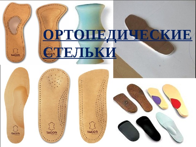 Ортопедические стельки 