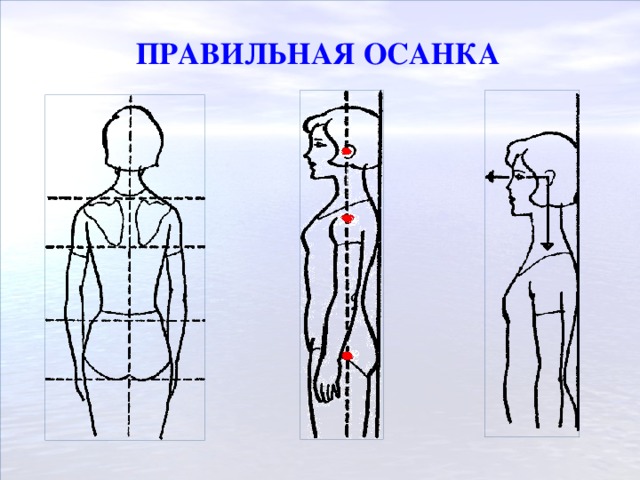 ПРАВИЛЬНАЯ ОСАНКА   