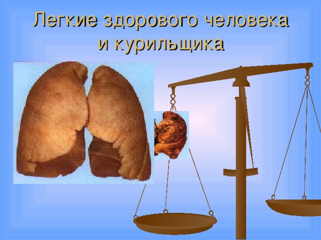 Легкие здорового человека  и курильщика 
