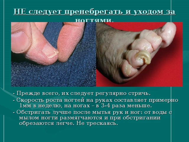 НЕ следует пренебрегать и уходом за ногтями. - Прежде всего, их следует регулярно стричь. - Скорость роста ногтей на руках составляет примерно 1мм в неделю, на ногах – в 3-4 раза меньше. - Обстригать лучше после мытья рук и ног: от воды с мылом ногти размягчаются и при обстригании обрезаются легче. Не трескаясь. 
