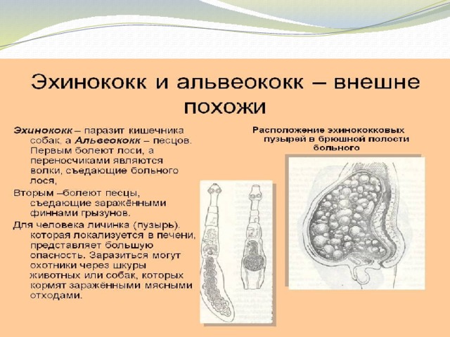 Поражение печени альвеококком схема
