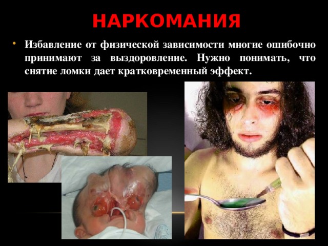 НАРКОМАНИЯ Избавление от физической зависимости многие ошибочно принимают за выздоровление. Нужно понимать, что снятие ломки дает кратковременный эффект. 