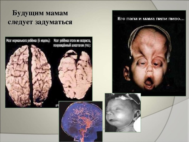 Будущим мамам следует задуматься 
