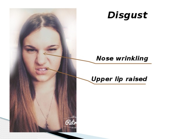 Disgust Nose wrinkling Upper lip raised  