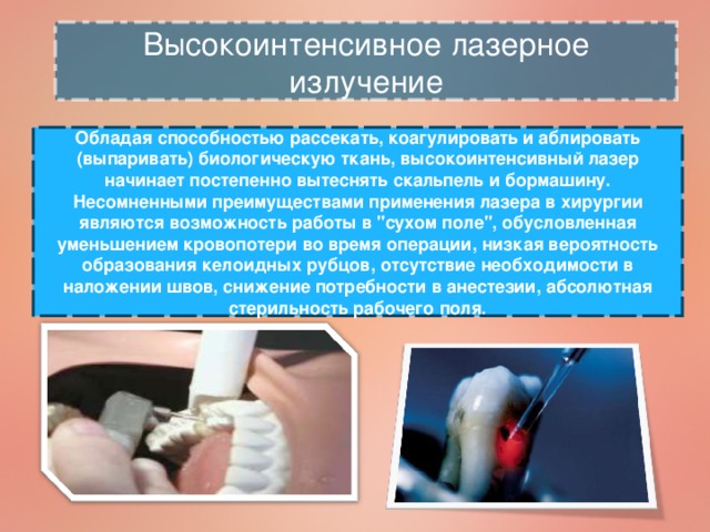 Высокоинтенсивное лазерное излучение Обладая способностью рассекать, коагулировать и аблировать (выпаривать) биологическую ткань, высокоинтенсивный лазер начинает постепенно вытеснять скальпель и бормашину. Несомненными преимуществами применения лазера в хирургии являются возможность работы в 