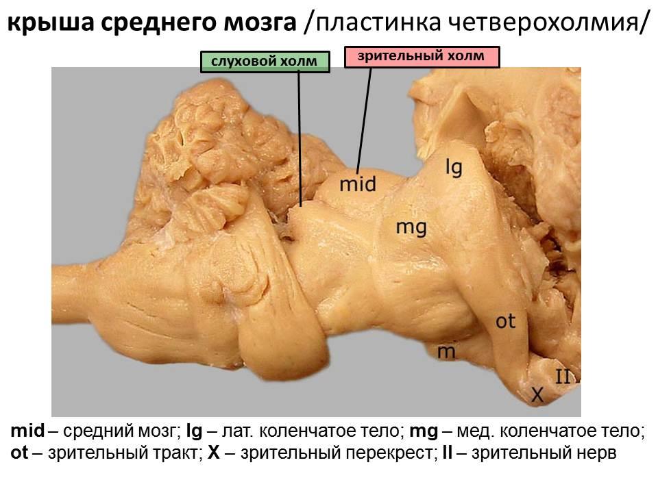 строение головного мозга коровы. Смотреть фото строение головного мозга коровы. Смотреть картинку строение головного мозга коровы. Картинка про строение головного мозга коровы. Фото строение головного мозга коровы