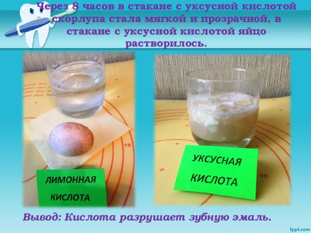 Через 8 часов в стакане с уксусной кислотой скорлупа стала мягкой и прозрачной, в стакане с уксусной кислотой яйцо растворилось. Вывод: Кислота разрушает зубную эмаль.