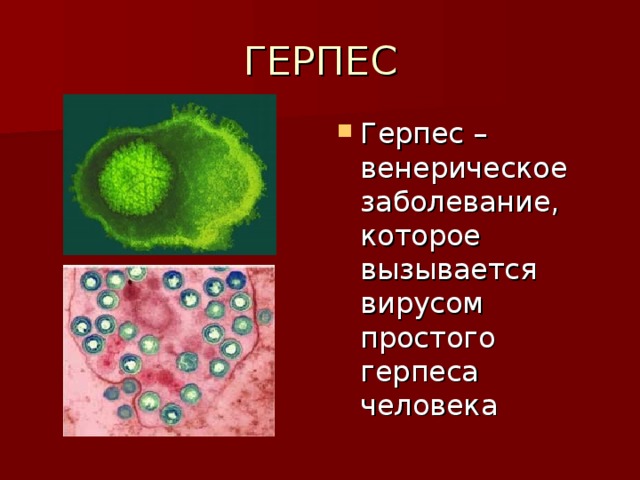 ГЕРПЕС Герпес – венерическое заболевание, которое вызывается вирусом простого герпеса человека 