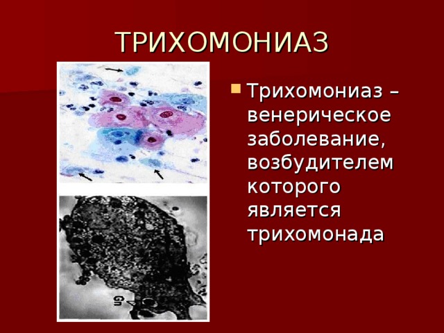 ТРИХОМОНИАЗ Трихомониаз – венерическое заболевание, возбудителем которого является трихомонада 