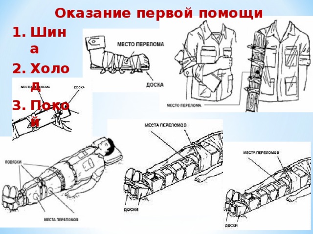 Оказание первой помощи Шина Холод Покой 