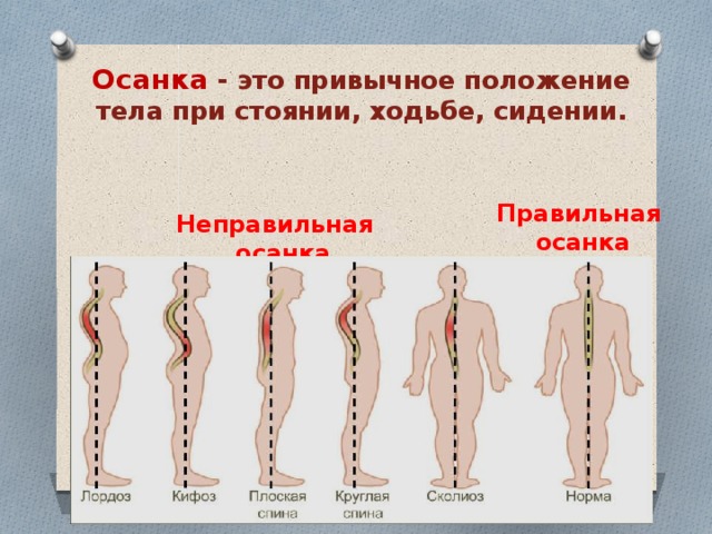Осанка  - это привычное положение тела при стоянии, ходьбе, сидении. Правильная осанка Неправильная осанка 