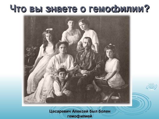 Что вы знаете о гемофилии? Цесаревич Алексей был болен гемофилией