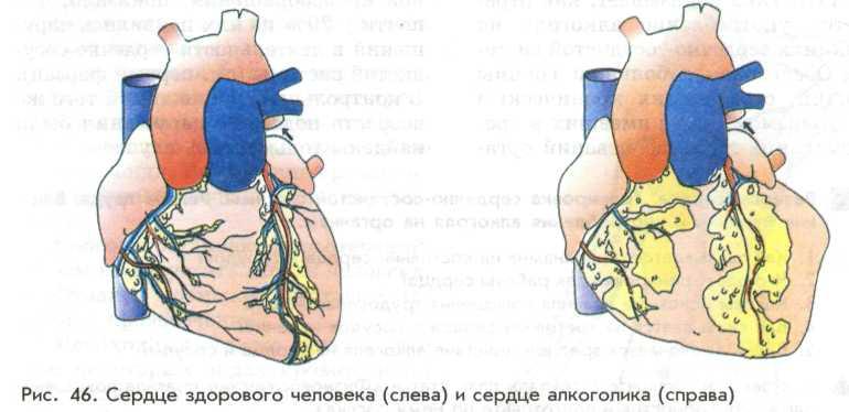 Сердце и алкоголь картинка