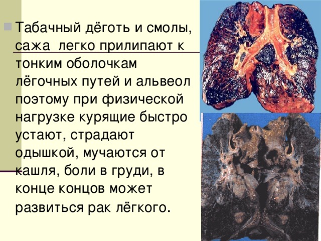 Табачный дёготь и смолы, сажа легко прилипают к тонким оболочкам лёгочных путей и альвеол поэтому при физической нагрузке курящие быстро устают, страдают одышкой, мучаются от кашля, боли в груди, в конце концов может развиться рак лёгкого . 