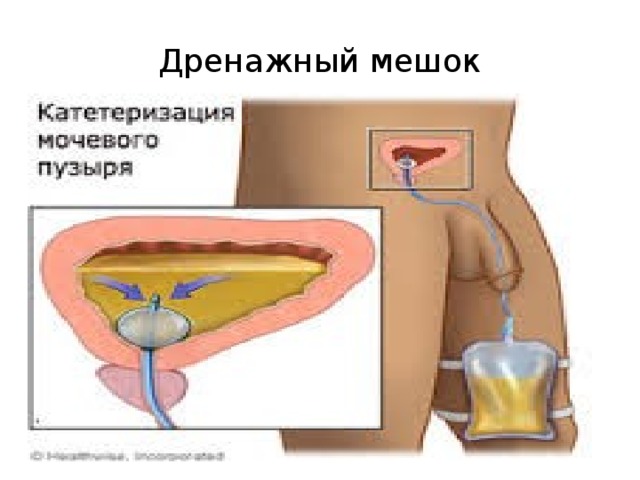 Дренажный мешок 