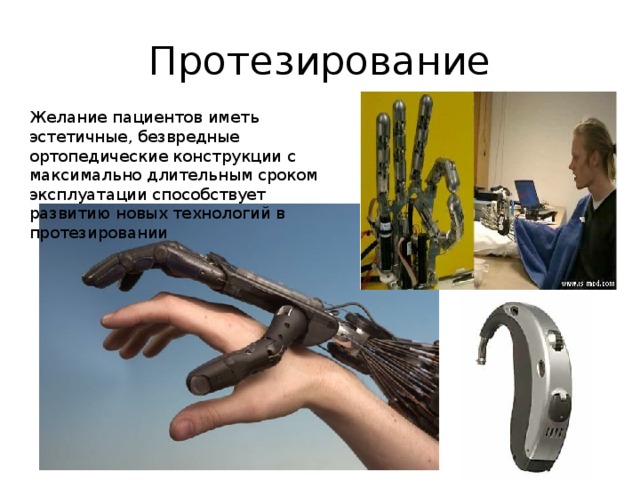 Протезирование Желание пациентов иметь эстетичные, безвредные ортопедические конструкции с максимально длительным сроком эксплуатации способствует развитию новых технологий в протезировании 