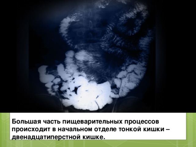 Большая часть пищеварительных процессов происходит в начальном отделе тонкой кишки – двенадцатиперстной кишке.  