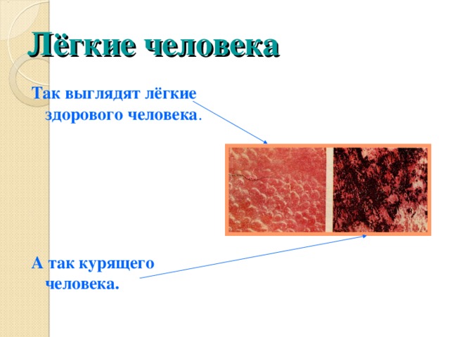 Лёгкие человека Так выглядят лёгкие здорового человека . А так курящего человека. 